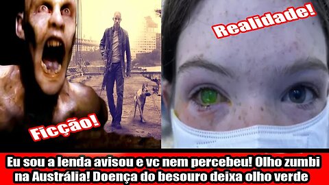 Eu sou a lenda avisou e vc nem percebeu! Olho zumbi na Austrália! Doença do besouro deixa olho verde