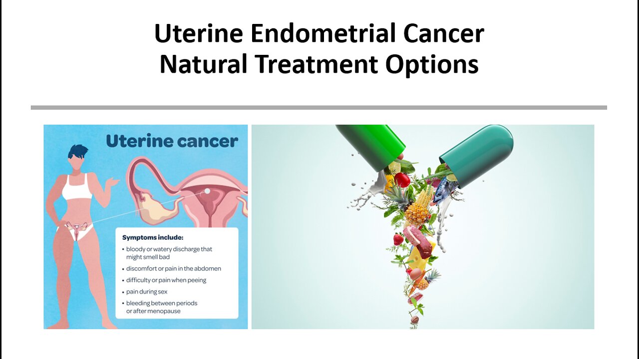 Uterine Endometrial Cancer - Natural Treatment Options