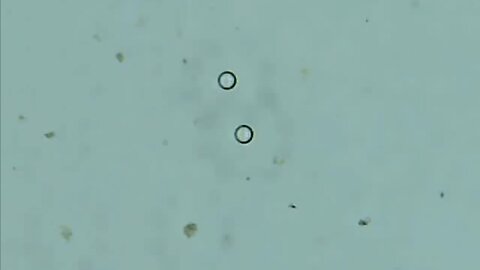 Tap Water Under the Microscope