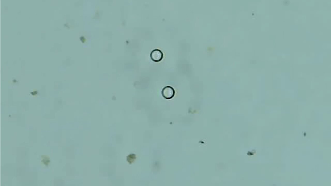 Tap Water Under the Microscope