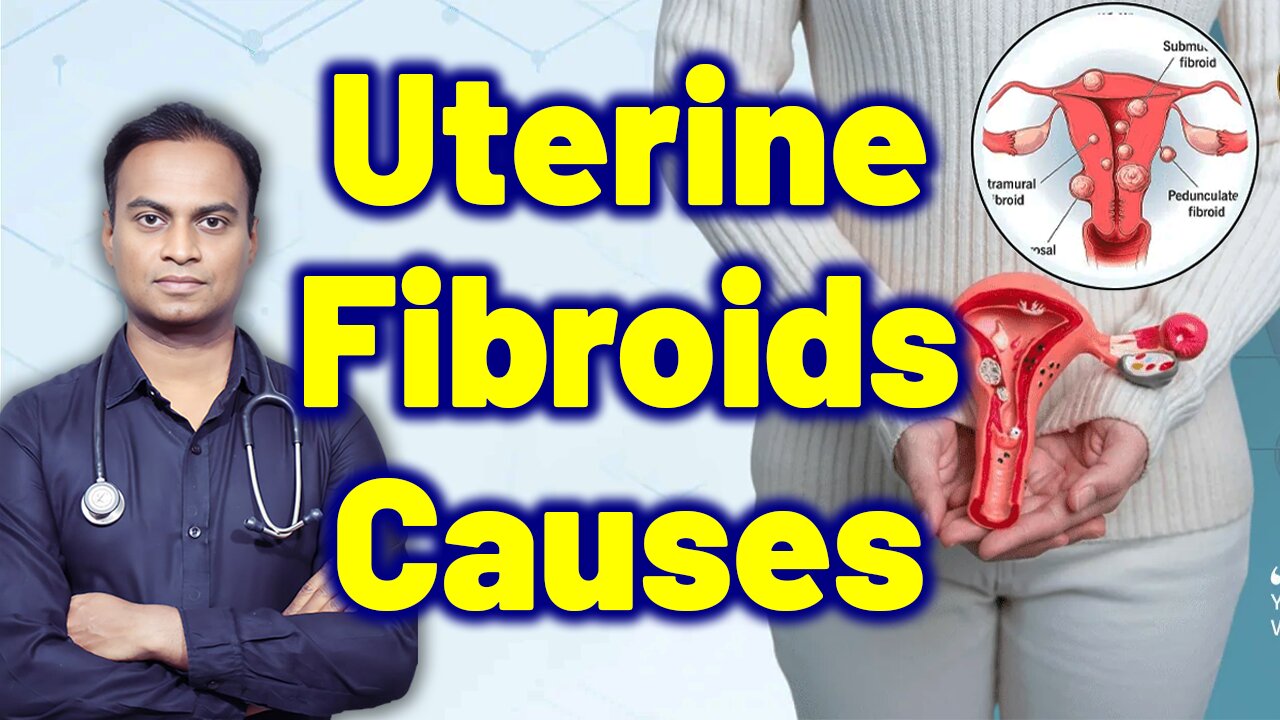 Causes For Uterine Fibroids Treatment Cure Medicine Surgery Gynaecology Women Female | Dr. Bharadwaz