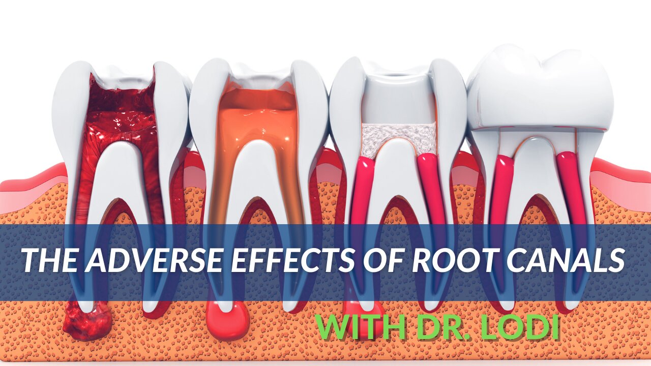 The Adverse Effects of Root Canals