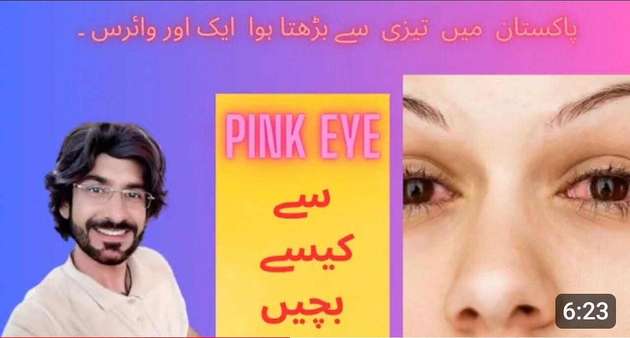 Eye Infection Causes, Symptoms & Treatment | Dangerous Virus Spread In Pakistan