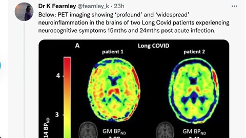 新冠後遺症 + 在辦公室感染新冠，是否「工傷」