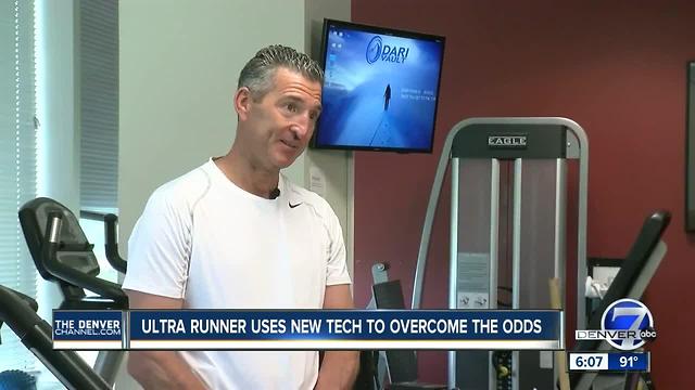 Finish line in sight for Leadville 100 runner thanks to new therapeutic tool