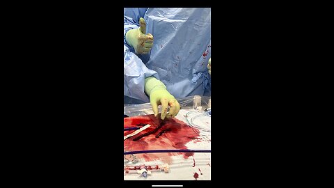 Prepare yourself * humanity is being purged SUDDEN DEATH