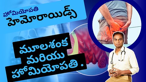 పైల్స్ మరియు హోమియోపతి చికిత్స.Dr. Bharadwaz | Homeopathy, Medicine & Surgery