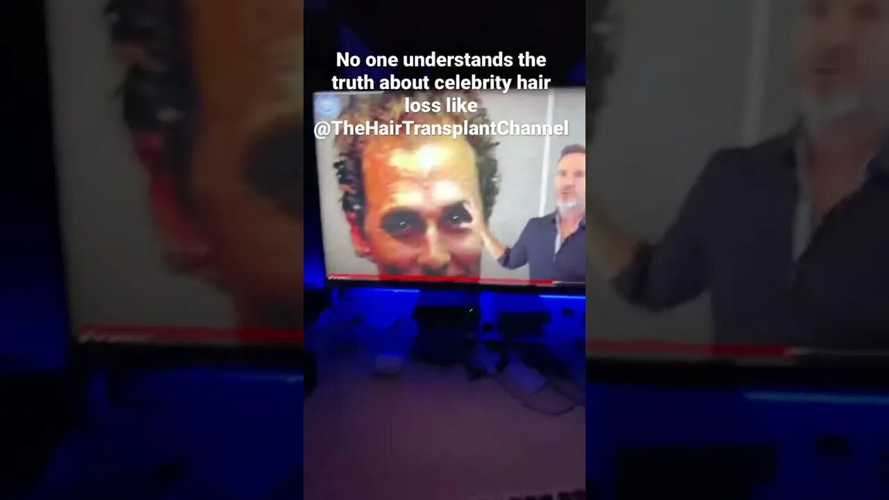 Celebrity Hair Transplants Matthew McConaughey