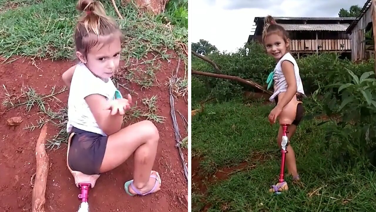 Little Girl With Only One Leg Triumphantly Climbs Hill