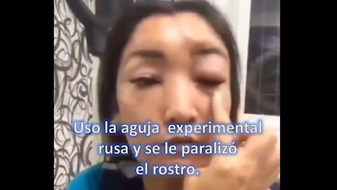 Uso el pinchazo ruso y se le paralizo la cara.