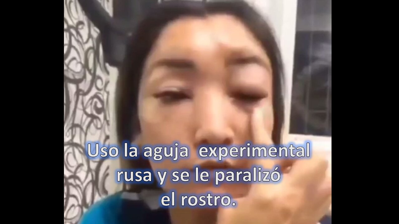 Uso el pinchazo ruso y se le paralizo la cara.