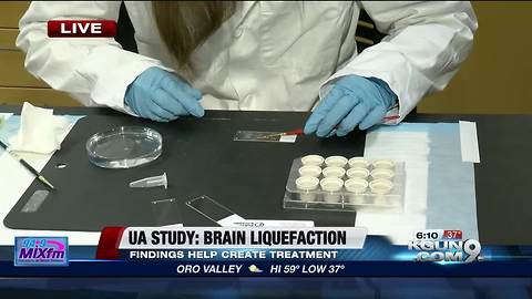 UA researchers: brain liquefaction after stroke is toxic to surviving brain