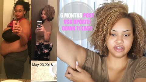 6 MTH VSG WEIGHT LOSS UPDATE HIGH PROTEIN DIET, HAIR SHEDDING, LOOSE SKIN ! BEFORE & AFTER PICS!