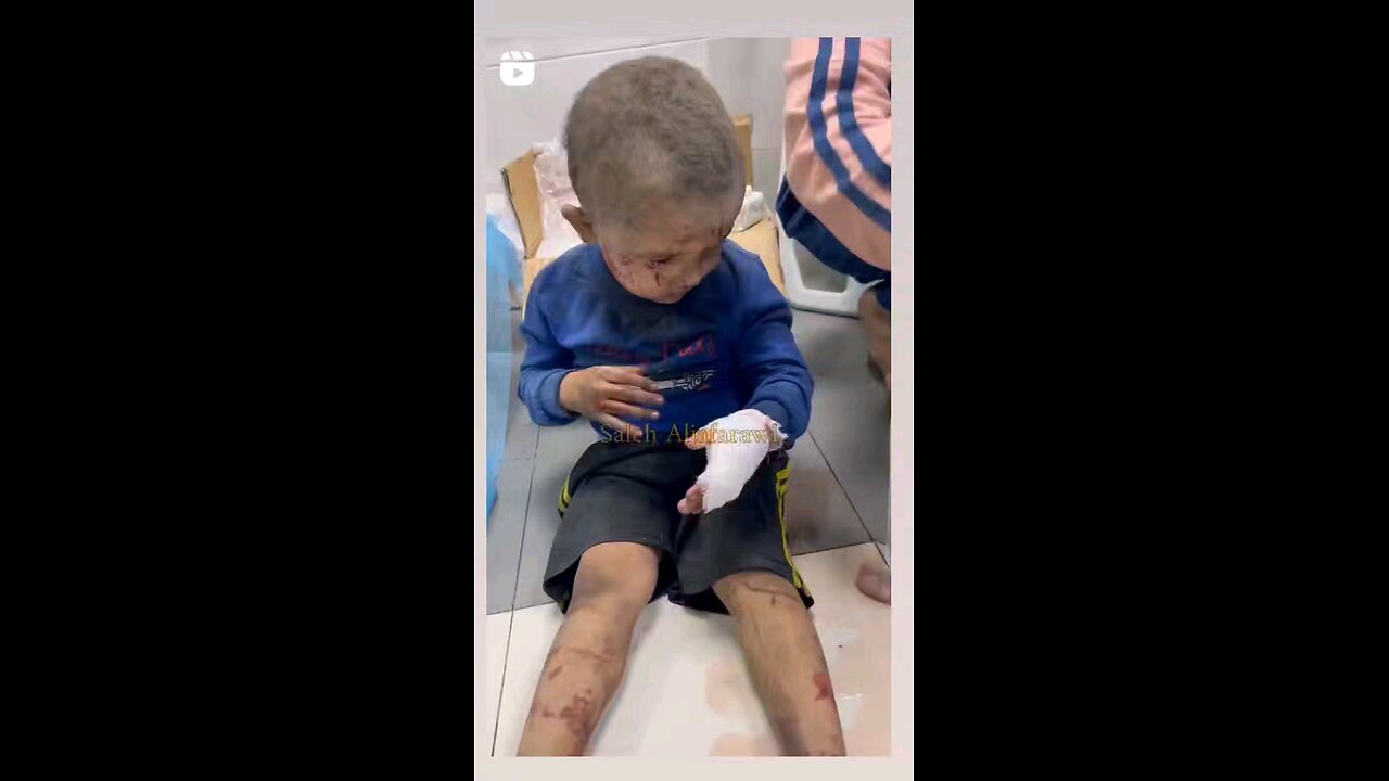 Watch the innocence of the baby and the brutality israel unleashesd