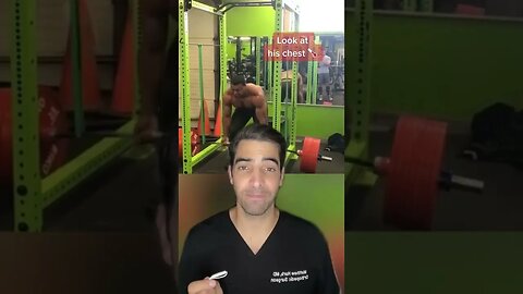 Bodybuilder heavy lift causes chest issues