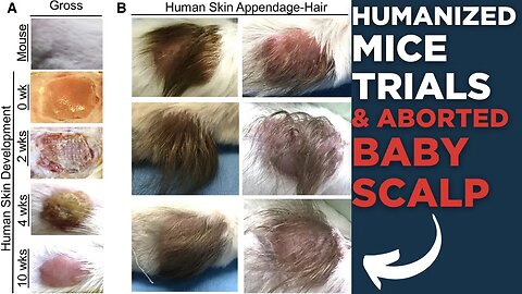 Aborted Babies GRAFTED ONTO HUMANIZED MICE🤮
