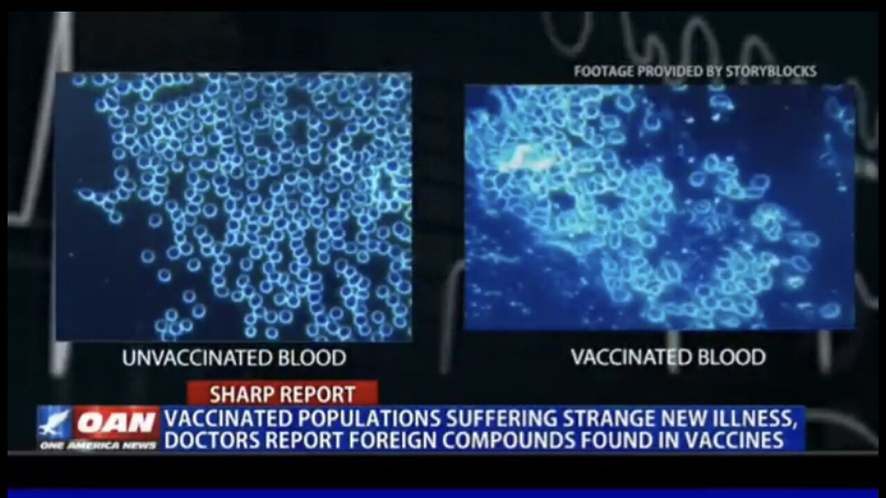 OAN Sounds The Alarm on the Covid Vaccines & What Appears to be New Terrifying Symptoms!