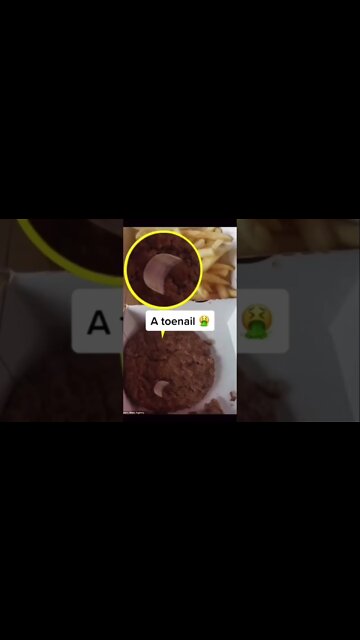 Don’t watch this video it’s disgusting #shorts