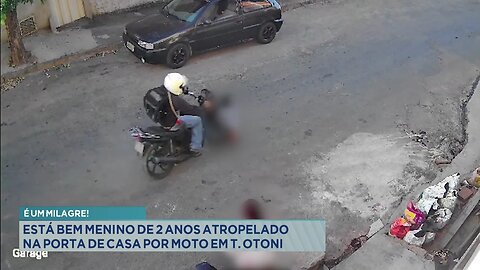 É um milagre!: Está bem menino de 2 anos atropelado na porta de casa por moto em T. Otoni.