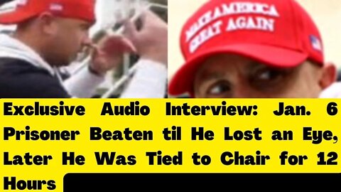 Jan. 6 Prisoner Beaten til He Lost an Eye, Later He Was Tied to Chair for 12 Hours
