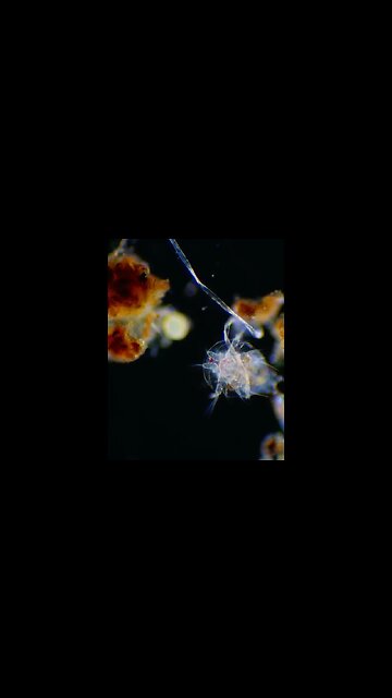 Micro Arthropod Eating Protozoa!