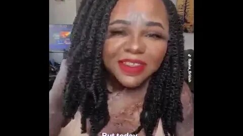 A Lady narrate how she escape death after fire disaster- Just thank God for wherever you are