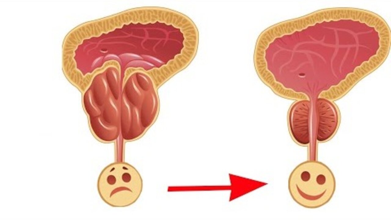 OBRADUJTE PROSTATU – Evo koju hranu treba jesti, a koju izbegavati