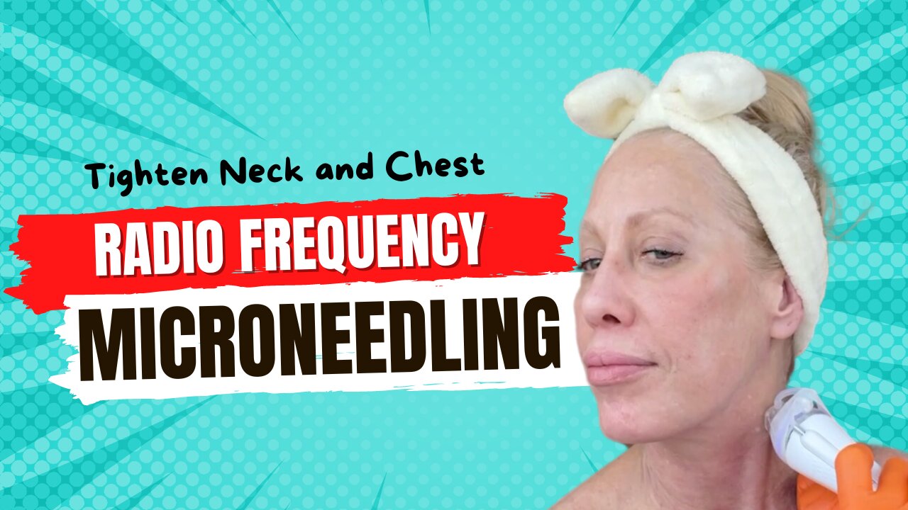 Tighten My Neck & Improve Chest Wrinkles with RF Microneedling