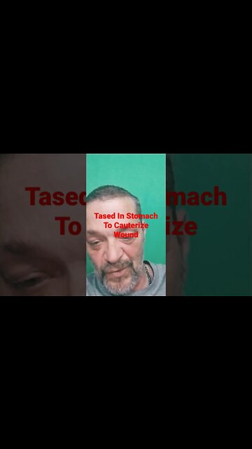 A Taser Is Not Cauterizer!