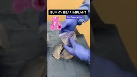 5th Gen Gummy Bear Implants 🧸 #shorts