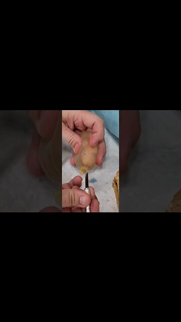 Womb Bag - How Babies Are Born #shorts