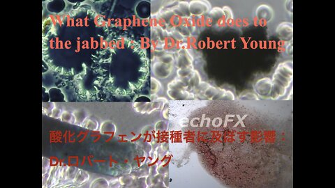 What Graphene Oxide does to the Jabbed