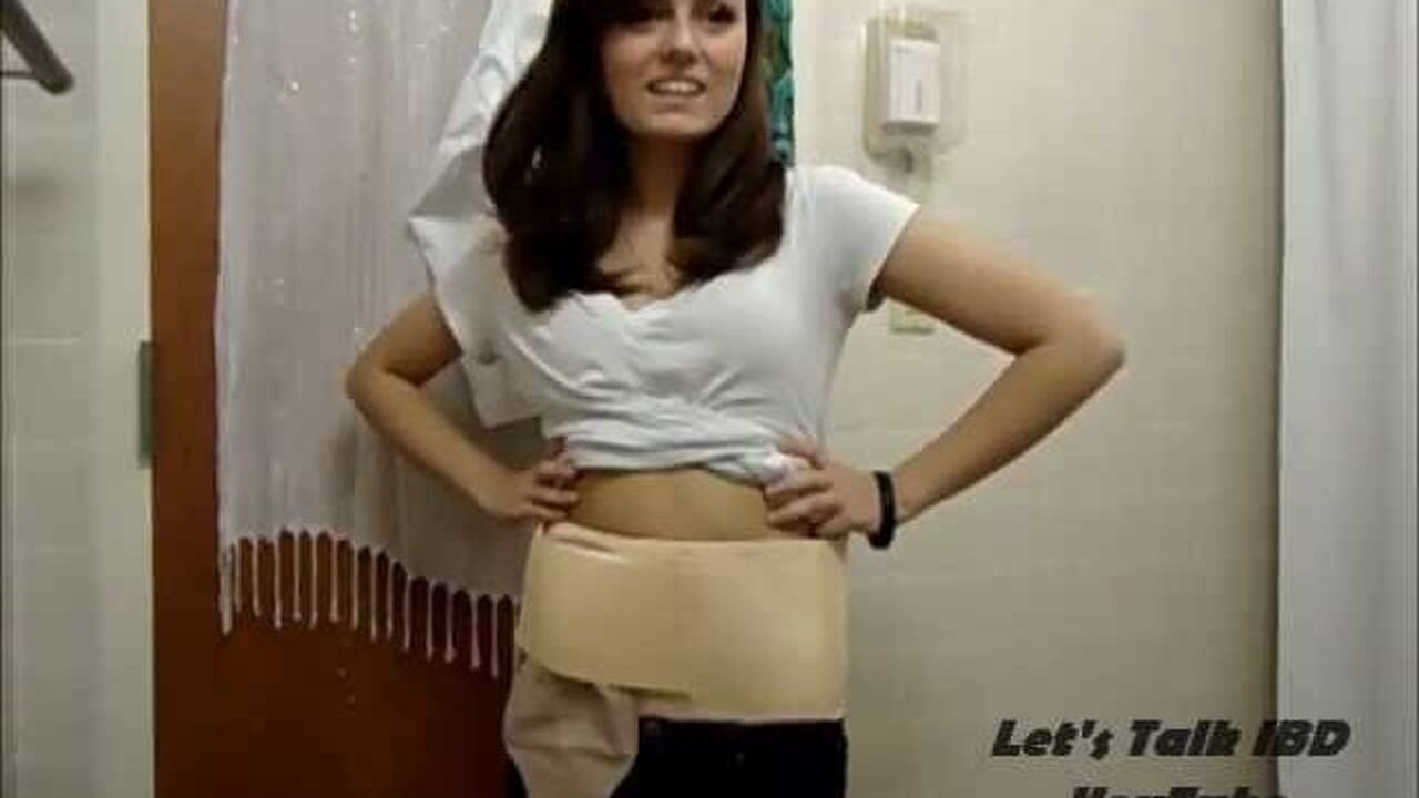 Modeling the Support Belt and Stoma Guard for Comfizz