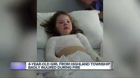 4-year-old girl from Highland Township badly burned during fire