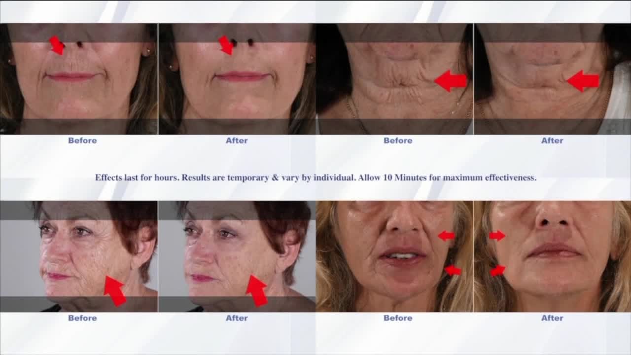 You'll Be Amazed At What Plexaderm Can Do For You!