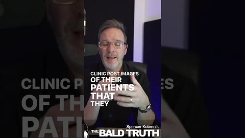 Ruined Lives By Amateur Hair Transplant Clinics #hairloss #podcast #hairtransplant