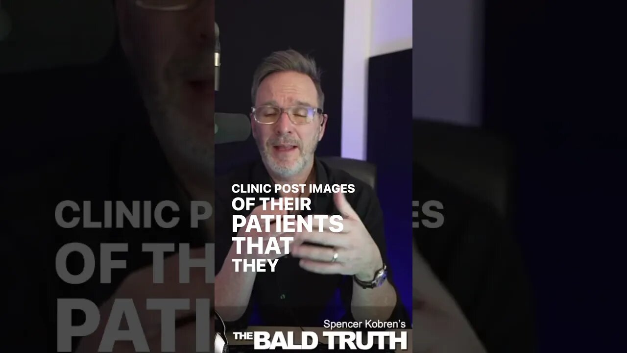Ruined Lives By Amateur Hair Transplant Clinics #hairloss #podcast #hairtransplant