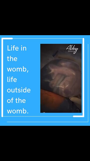 Life in both locations.