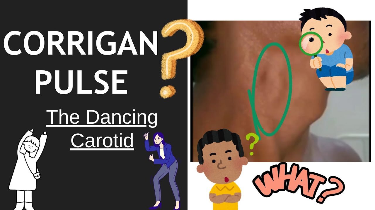 Corrigan's Sign Explained | Dancing Carotid Pulse | Novice Medic