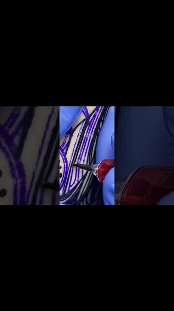 Anyone know this needle size?