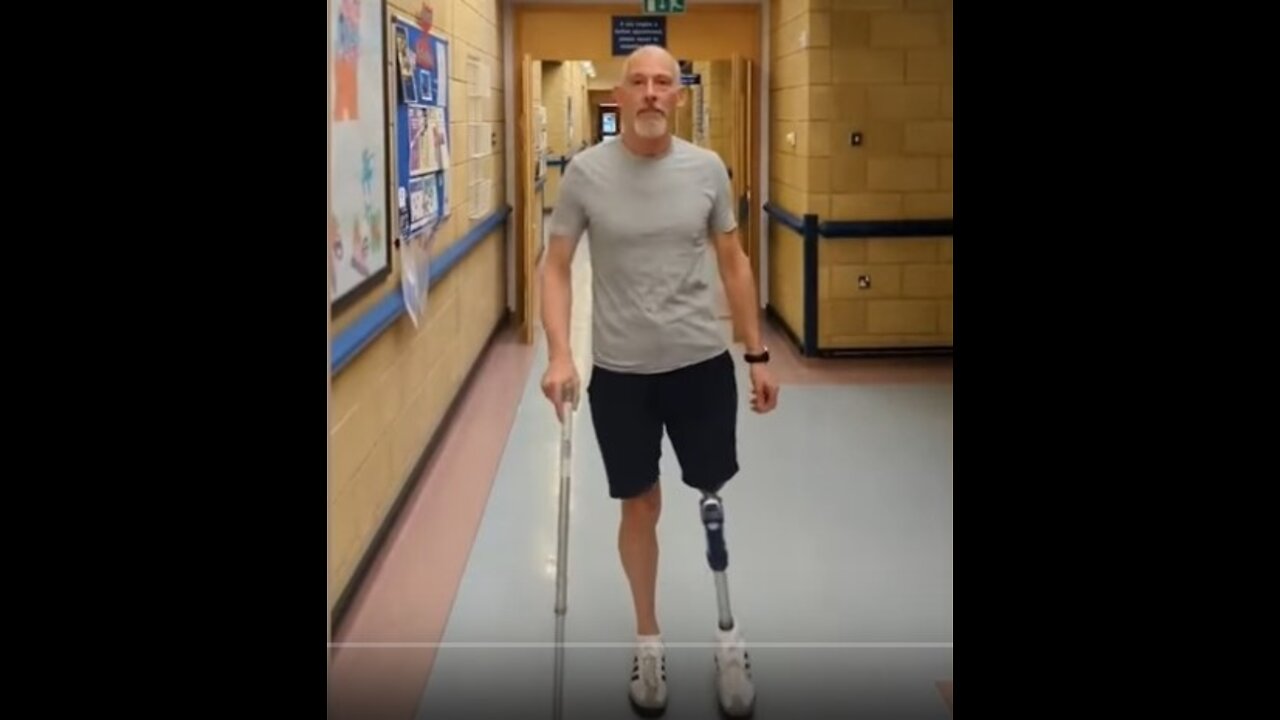 Alex Mitchell Lost His Leg After Having the AstraZeneca Vaccination