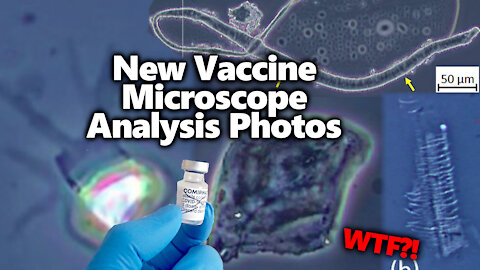 Strange Objects: Fascinating Pfizer Vaccine Microscope Photos Just Released By Dr John B