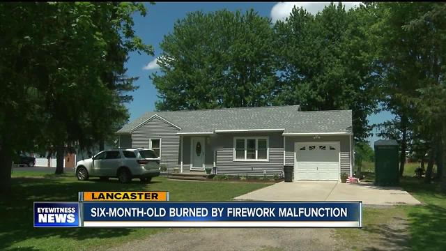 Baby struck by malfunctioning firework
