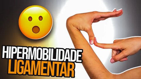 O Que é Síndrome da Hipermobilidade Ligamentar