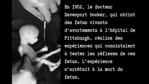 Expérimentations du Dr Davenport Hooker (université de Pittsburgh) en 1952 sur des foetus vivants