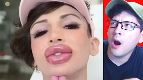 Model Spent $100,000 On Plastic Surgery...
