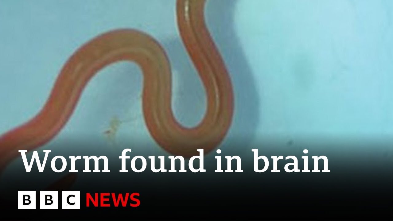 Live worm found in Australian woman's brain - BBZNews