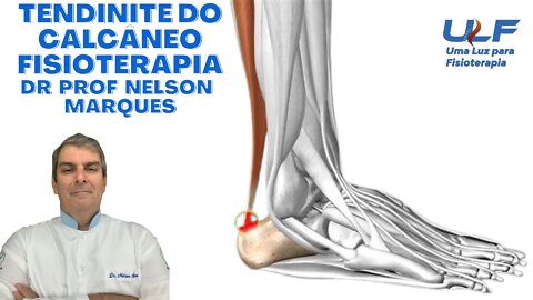 TENDINITE DE CALCÂNEO ("AQUILES") - Dr. Prof. Nelson Marques