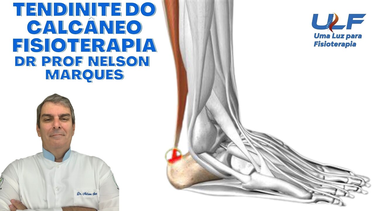 TENDINITE DE CALCÂNEO ("AQUILES") - Dr. Prof. Nelson Marques