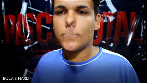 Colando boca e nariz com SUPERBONDER